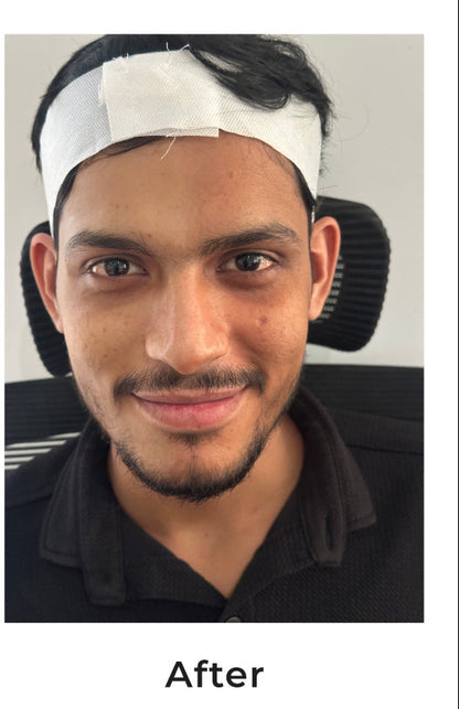 Niconi Tan Vanish Gluta-Kojic Skin Polish - Salon