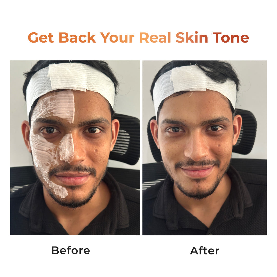 Niconi Tan Vanish Gluta-Kojic Skin Polish 180g