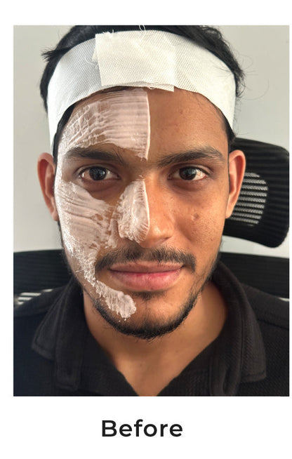 Niconi Tan Vanish Gluta-Kojic Skin Polish - B2B