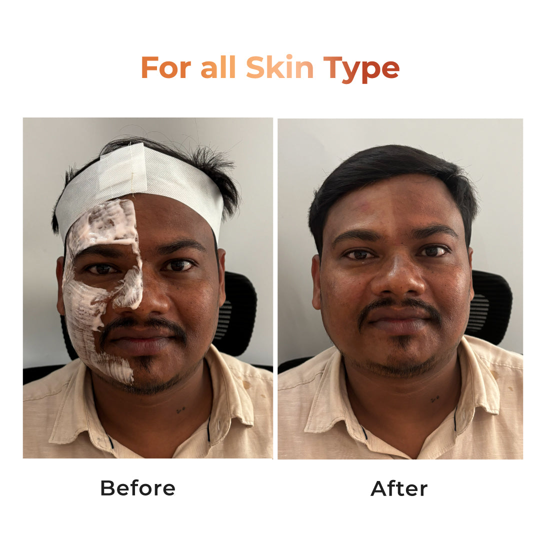 Niconi Tan Vanish Gluta-Kojic Skin Polish - B2B