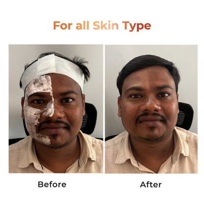 Niconi Tan Vanish Gluta-Kojic Skin Polish 180g