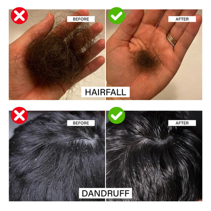 Niconi Herbal Hair Oil 200ml