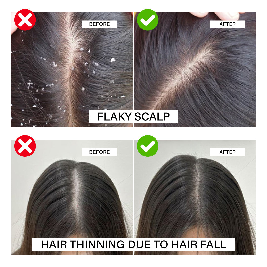 Niconi Herbal Hair Oil 200ml (B2B)