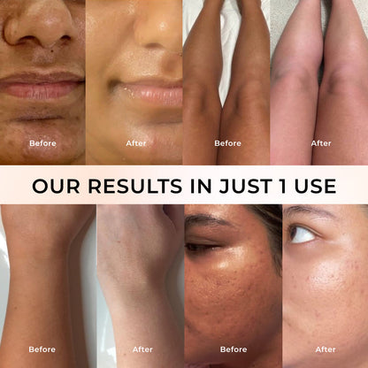 Niconi Tan Vanish Gluta-Kojic Skin Polish | Instant Tan Removal!