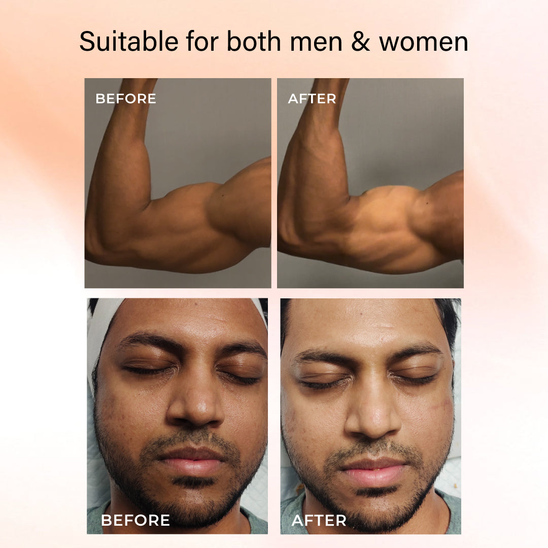 Niconi Tan Vanish Gluta-Kojic Skin Polish | Instant Tan Removal!